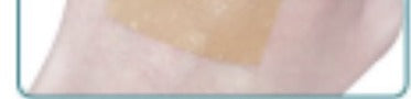 Applying a silicone scar strip to skin after C-section or tummy tuck surgery
